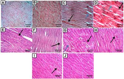 Combination of Panax ginseng C. A. Mey and Febuxostat Boasted Cardioprotective Effects Against Doxorubicin-Induced Acute Cardiotoxicity in Rats